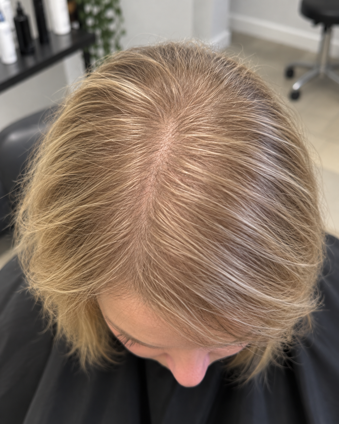 Ansatz und Kopfhaut nach der Routine mit Capelli Emotions